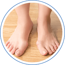 Bunions Treatment in Houston, TX 77095