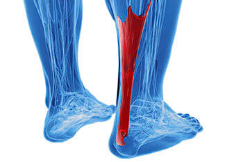 achilles tendon treatment in the Houston, TX 77095 area