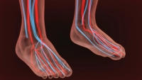 What Can Cause Poor Circulation?