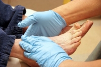 Causes of Diabetic Foot Pain