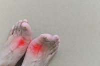 Do I Have Gout?