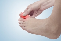 What Is a Gout Attack?